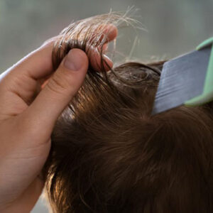 Removing Lice from Hair in Dream Meaning: What Does It Mean?