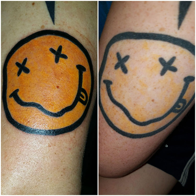 What the X Eyed Smiley Face Tattoo Means: An Informative Guide