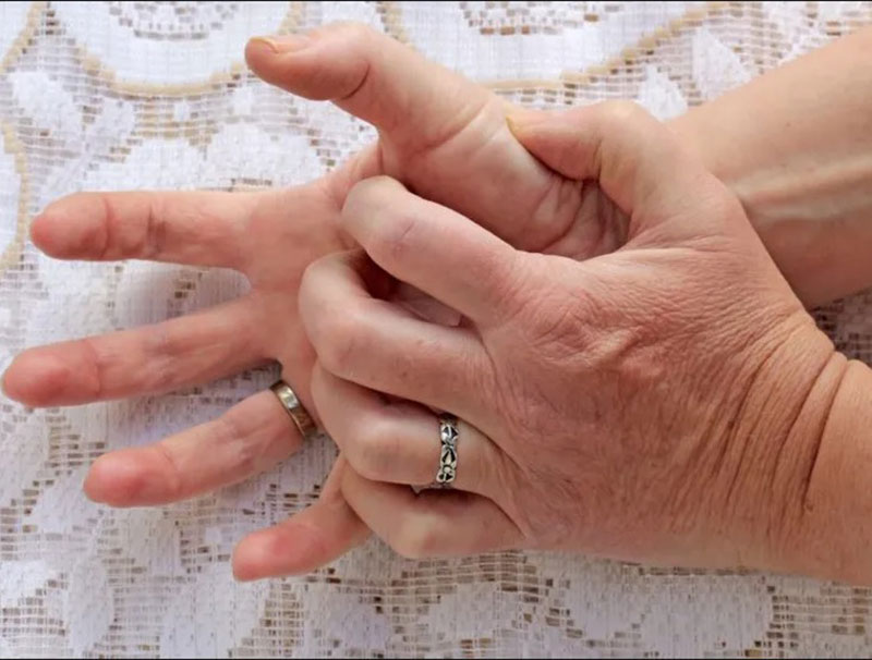 Understanding the Spiritual Meaning of Itching on Your Right Hand
