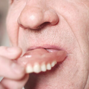 Decoding Your Dream About False Teeth: What Does It Mean?
