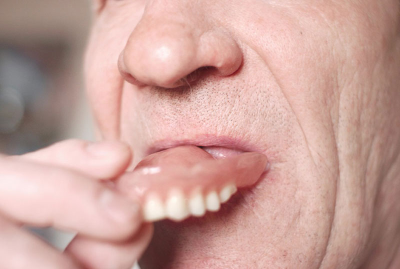 Decoding Your Dream About False Teeth: What Does It Mean?