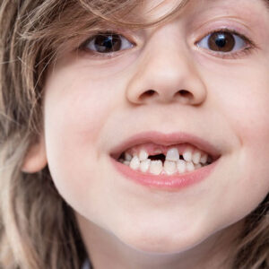 Dream about Teeth Crumbling and Spitting Out: Good or Bad?