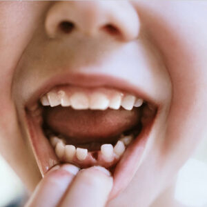 Cracking the Code: Unraveling the Dream Meaning of Teeth