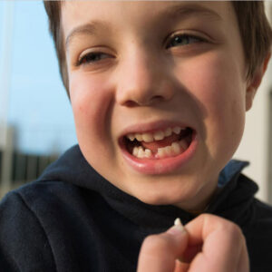 Dreams About Teeth Being Pulled Out: What They Really Mean